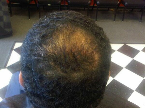 2_weeks_after.jpg