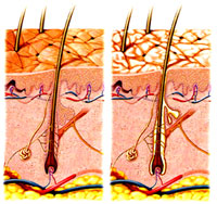 follicle-comparison2web.jpg